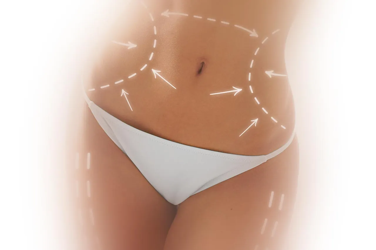 Cryo Body Slimming Fat Removal